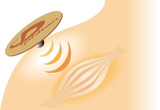 A stylised illustration of a light-coloured area of skin featuring a round, beige ‘ Phiten ’ Power Tape. In the centre is a small titanium sphere from which golden waves radiate. Next to it is a schematic muscle, glowing faintly gold.